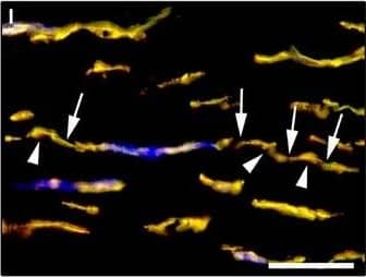 Detection of Human PDGFR alpha by Immunocytochemistry/Immunofluorescence