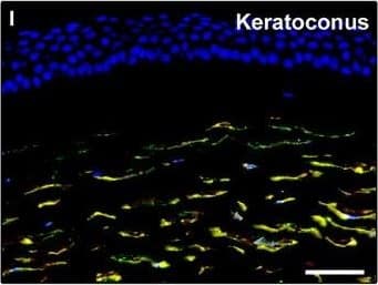 Detection of Human PDGFR alpha by Immunocytochemistry/Immunofluorescence