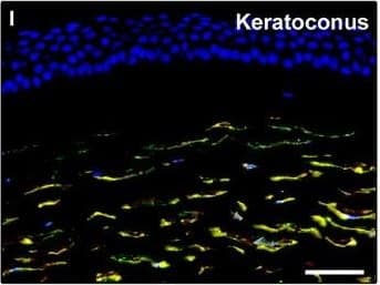 Detection of Human PDGFR alpha by Immunocytochemistry/Immunofluorescence