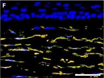 Detection of Human PDGFR alpha by Immunocytochemistry/Immunofluorescence
