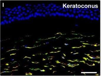 Detection of Human PDGFR alpha by Immunocytochemistry/Immunofluorescence