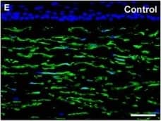 Detection of Human PDGFR alpha by Immunocytochemistry/Immunofluorescence