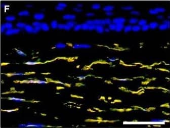 Detection of Human PDGFR alpha by Immunocytochemistry/Immunofluorescence