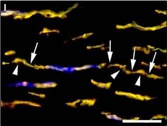 Detection of Human PDGFR alpha by Immunocytochemistry/Immunofluorescence
