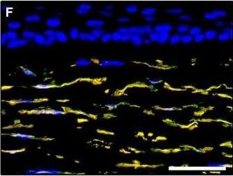 Detection of Human PDGFR alpha by Immunocytochemistry/Immunofluorescence