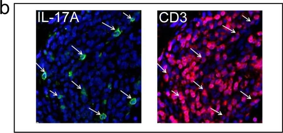 Detection of Human IL-17/IL-17A by Immunohistochemistry