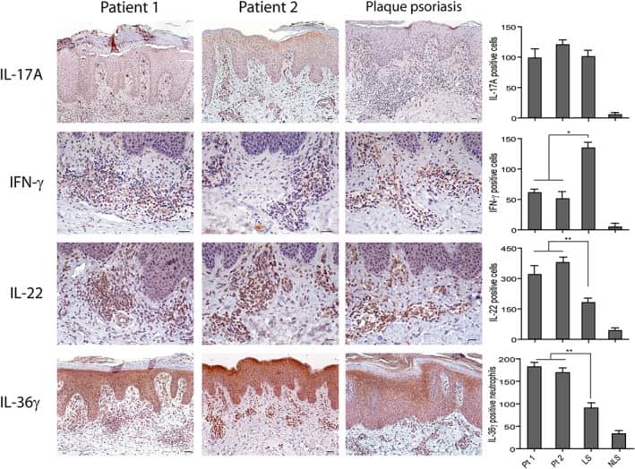 Detection of Human IL-17/IL-17A by Immunohistochemistry