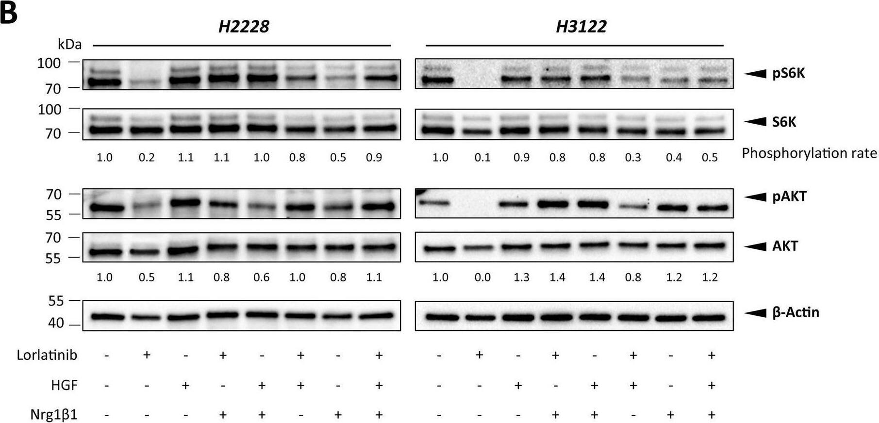 Detection of NRG1-beta 1/HRG1-beta 1 EGF by Western Blot