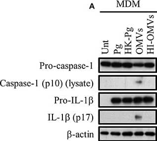 Detection of Human IL-1 beta/IL-1F2 by Western Blot