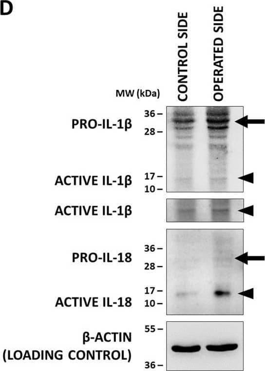 Detection of Mouse IL-1 beta/IL-1F2 by Western Blot