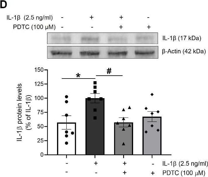 Detection of IL-1 beta/IL-1F2 by Western Blot