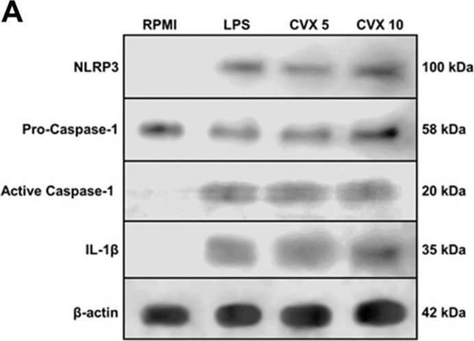 Detection of IL-1 beta/IL-1F2 by Western Blot