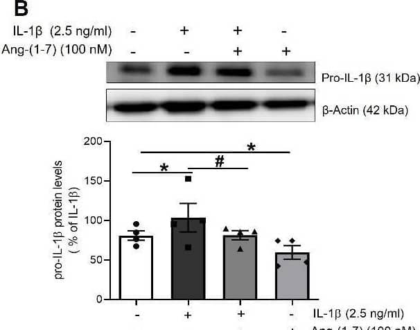Detection of IL-1 beta/IL-1F2 by Western Blot