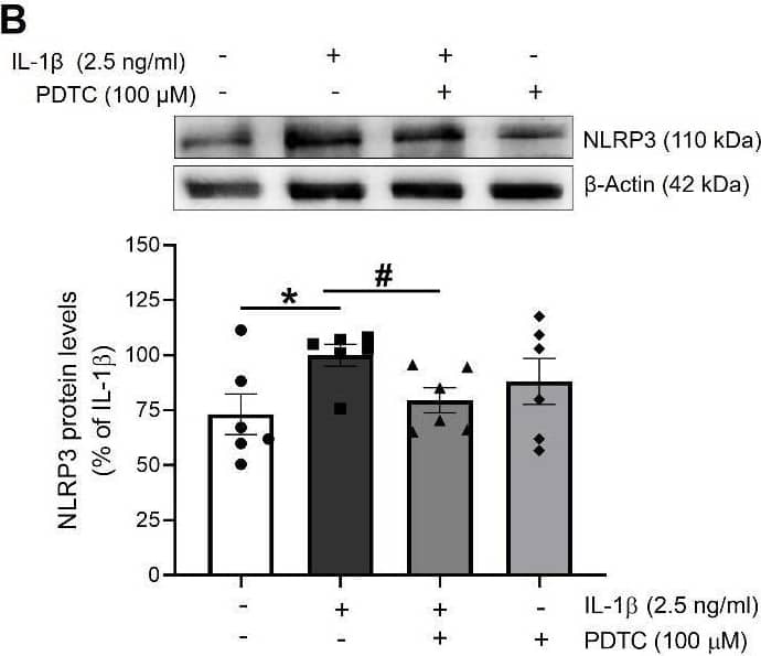 Detection of IL-1 beta/IL-1F2 by Western Blot