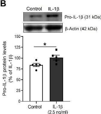 Detection of IL-1 beta/IL-1F2 by Western Blot