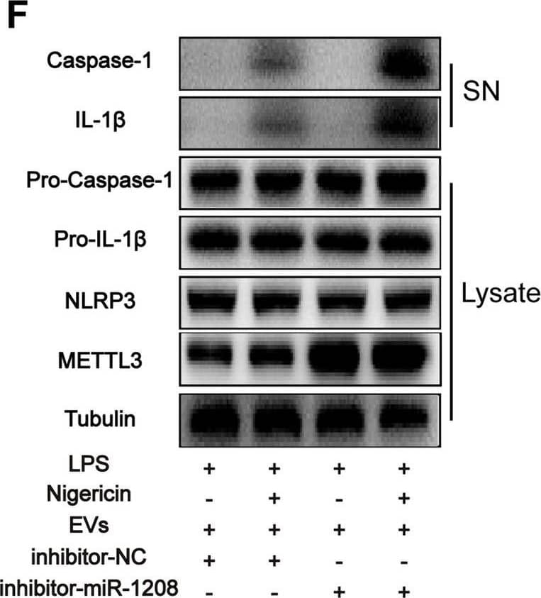 Detection of IL-1 beta/IL-1F2 by Western Blot