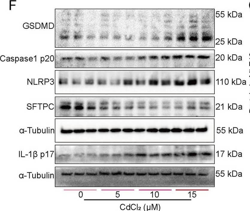 Detection of IL-1 beta/IL-1F2 by Western Blot