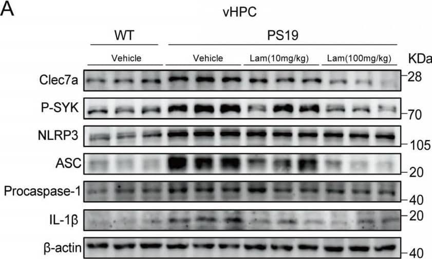 Detection of IL-1 beta/IL-1F2 by Western Blot