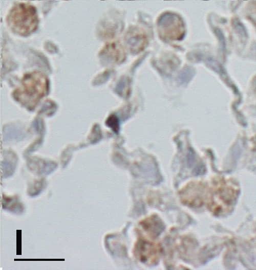 Detection of Mouse IL-13 by Immunohistochemistry