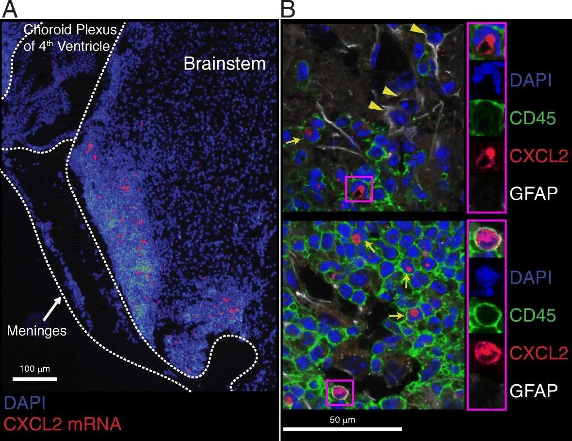 Detection of Mouse CXCL2/GRO beta/MIP-2/CINC-3 by Immunohistochemistry