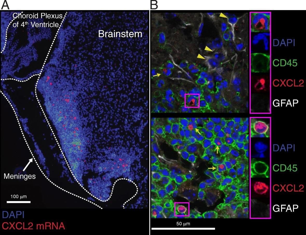 Detection of Mouse CXCL2/GRO beta/MIP-2/CINC-3 by Immunohistochemistry