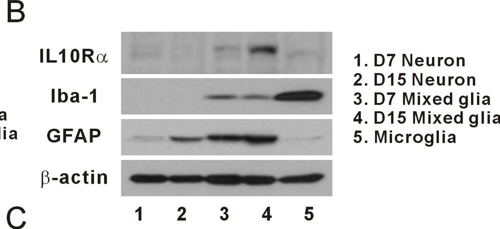 Detection of Porcine IL-10R alpha by Western Blot