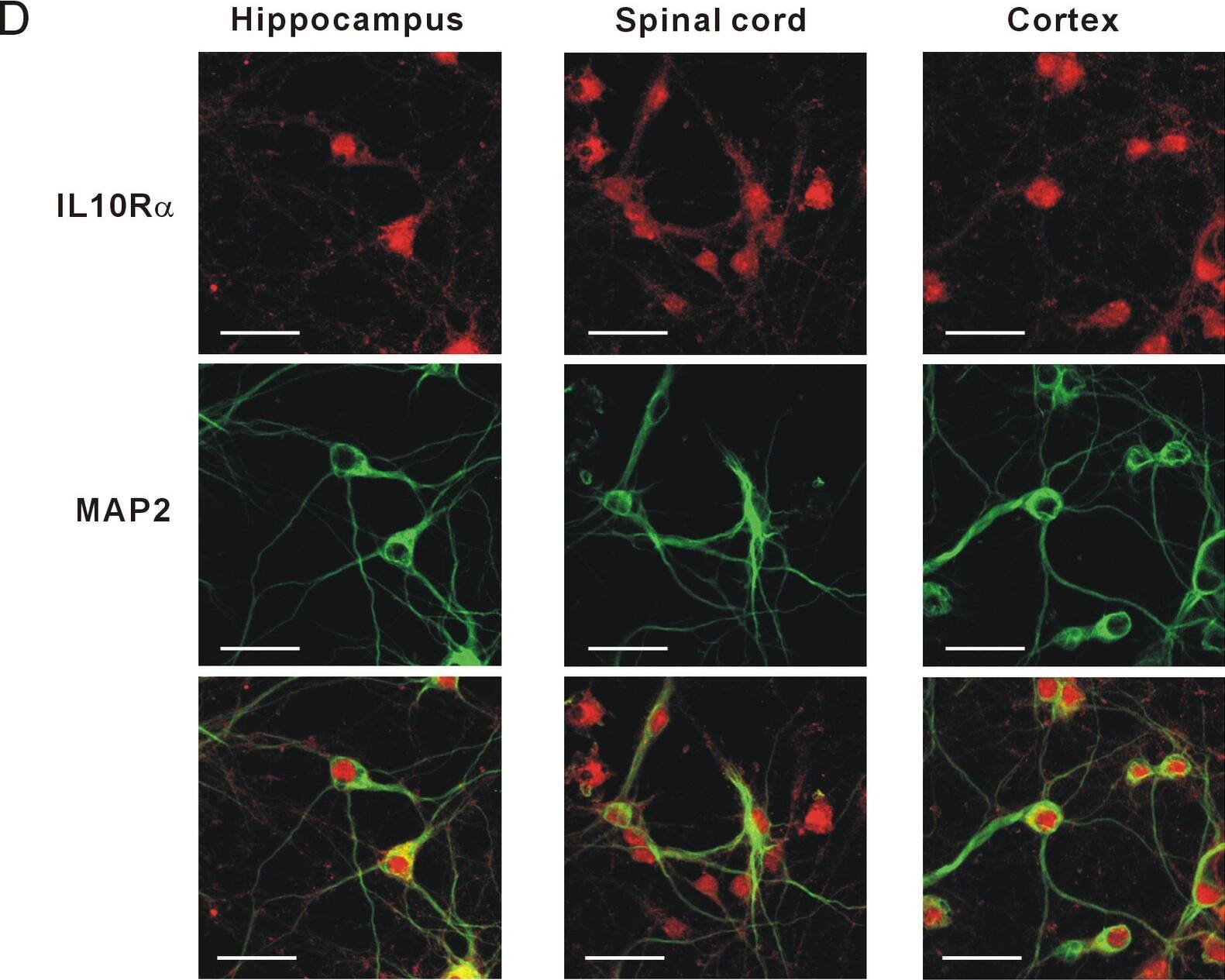 Detection of Porcine IL-10R alpha by Immunocytochemistry/ Immunofluorescence
