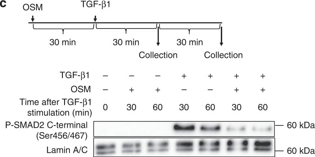 Detection of Mouse Oncostatin M/OSM by Western Blot