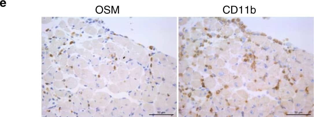 Detection of Mouse Oncostatin M/OSM by Immunohistochemistry