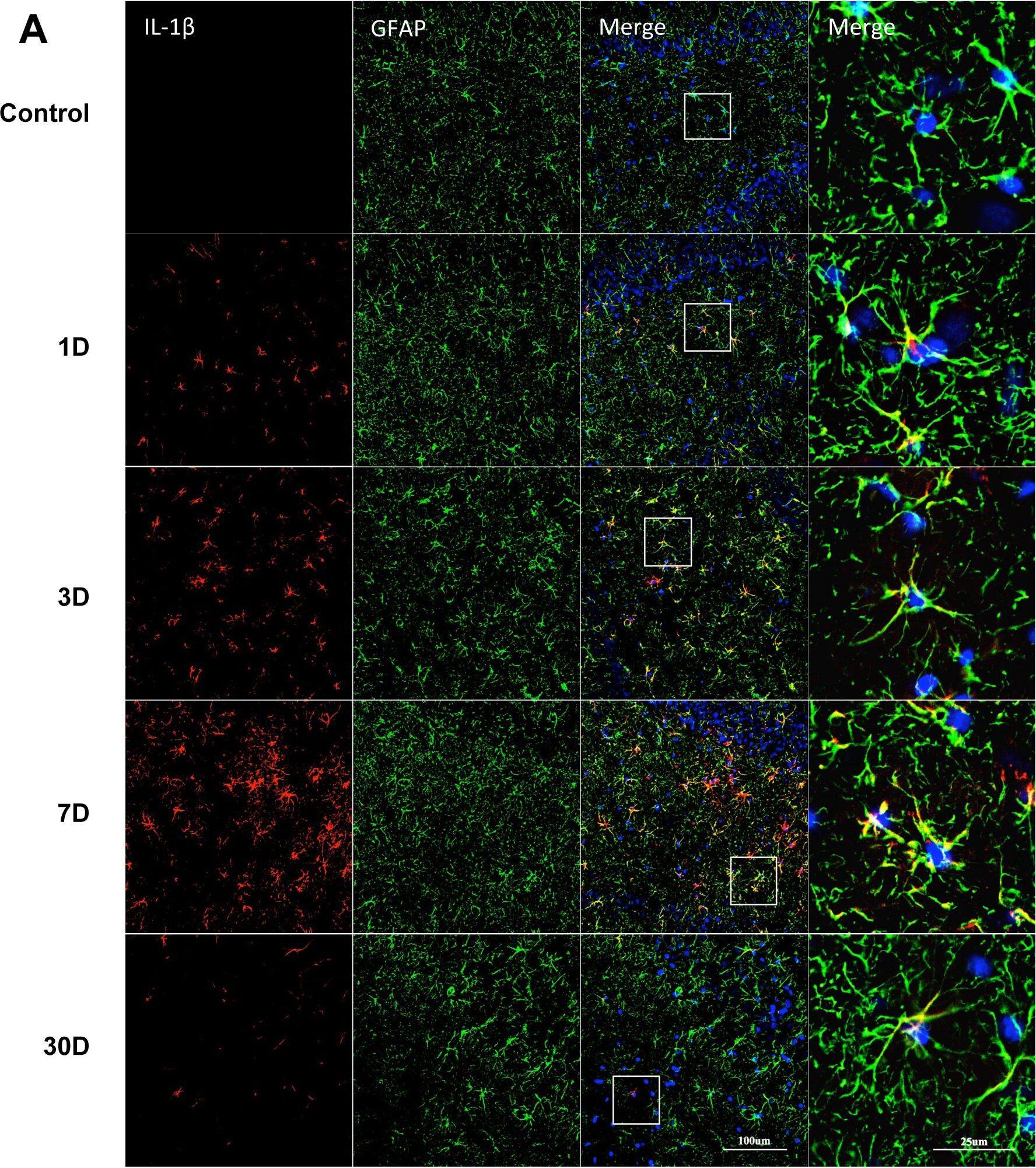 Detection of Rat IL-1 beta/IL-1F2 by Immunocytochemistry/ Immunofluorescence