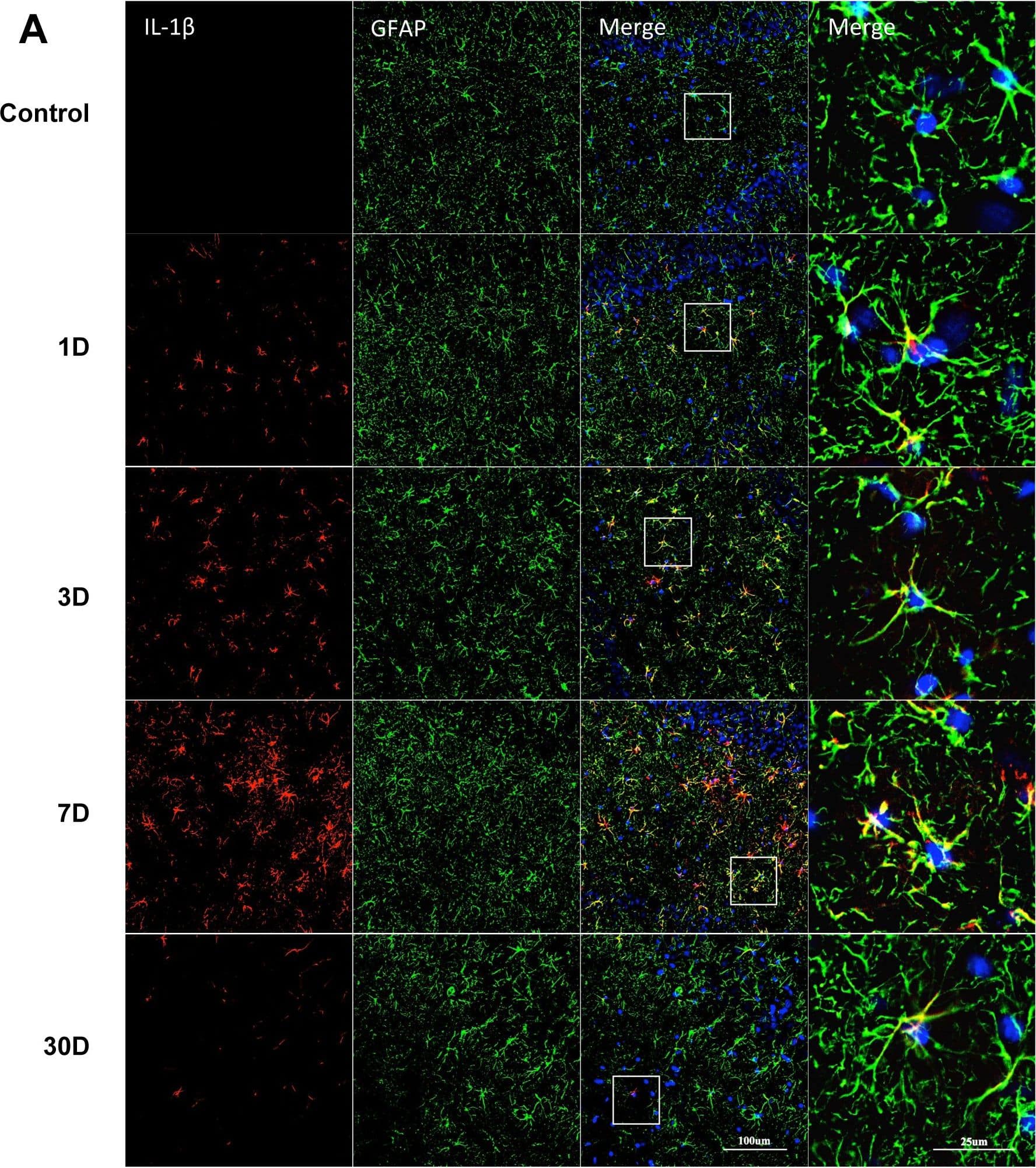 Detection of Porcine IL-1 beta/IL-1F2 by Immunocytochemistry/ Immunofluorescence