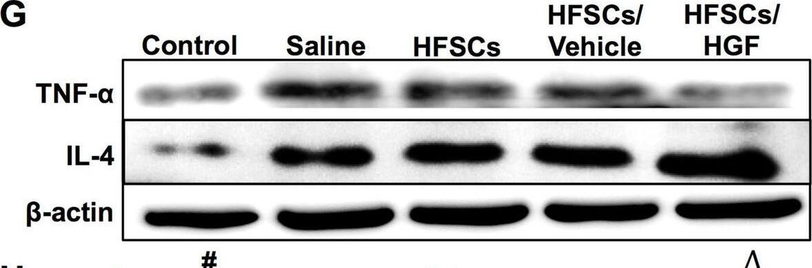 Detection of IL-4 by Western Blot