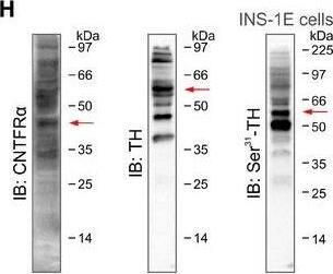 Detection of Rat CNTFR alpha by Western Blot