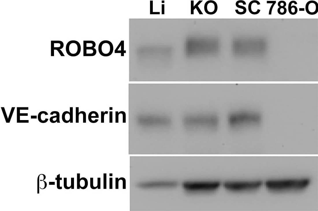 Detection of Mouse Mouse VE-Cadherin Antibody by Western Blot