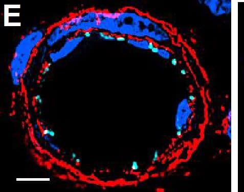 Detection of Mouse VE-Cadherin by Immunocytochemistry/Immunofluorescence