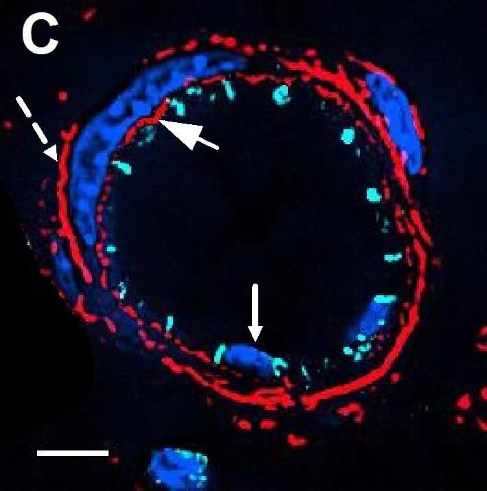 Detection of Mouse VE-Cadherin by Immunocytochemistry/Immunofluorescence