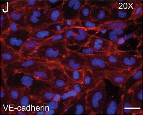 Detection of Mouse VE-Cadherin by Immunocytochemistry/Immunofluorescence