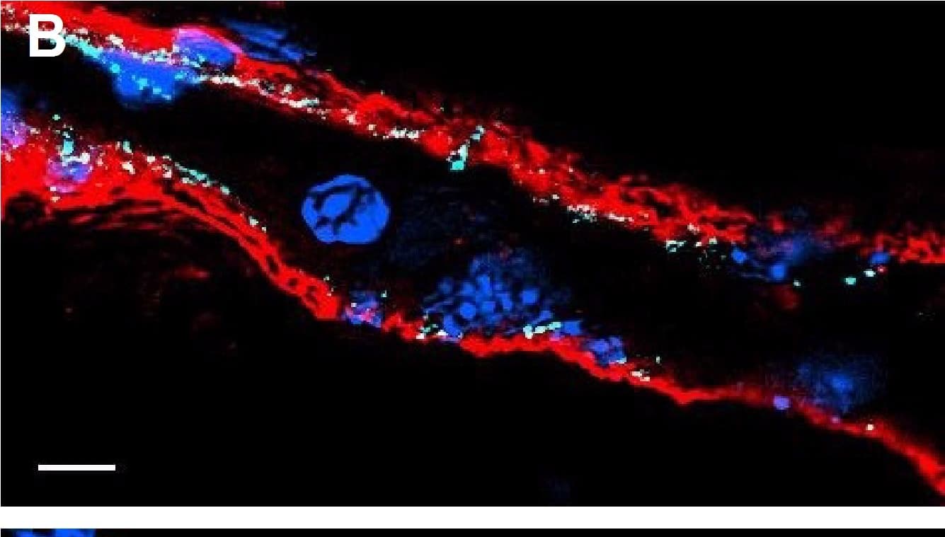 Detection of Mouse VE-Cadherin by Immunocytochemistry/Immunofluorescence