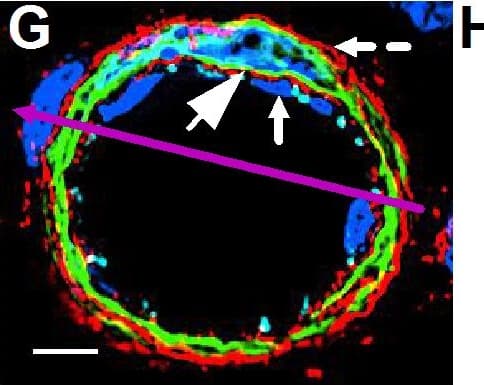 Detection of Mouse VE-Cadherin by Immunocytochemistry/Immunofluorescence