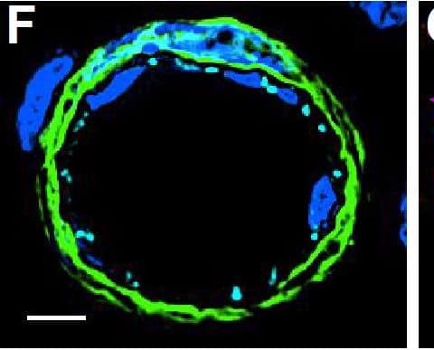 Detection of Mouse VE-Cadherin by Immunocytochemistry/Immunofluorescence