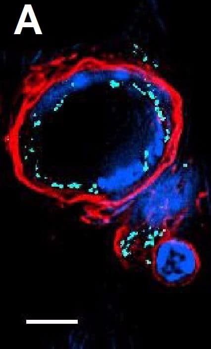 Detection of Mouse VE-Cadherin by Immunocytochemistry/Immunofluorescence