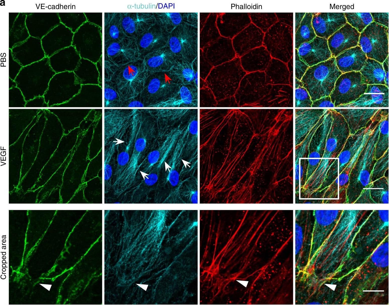 Detection of Mouse VE-Cadherin by Immunohistochemistry
