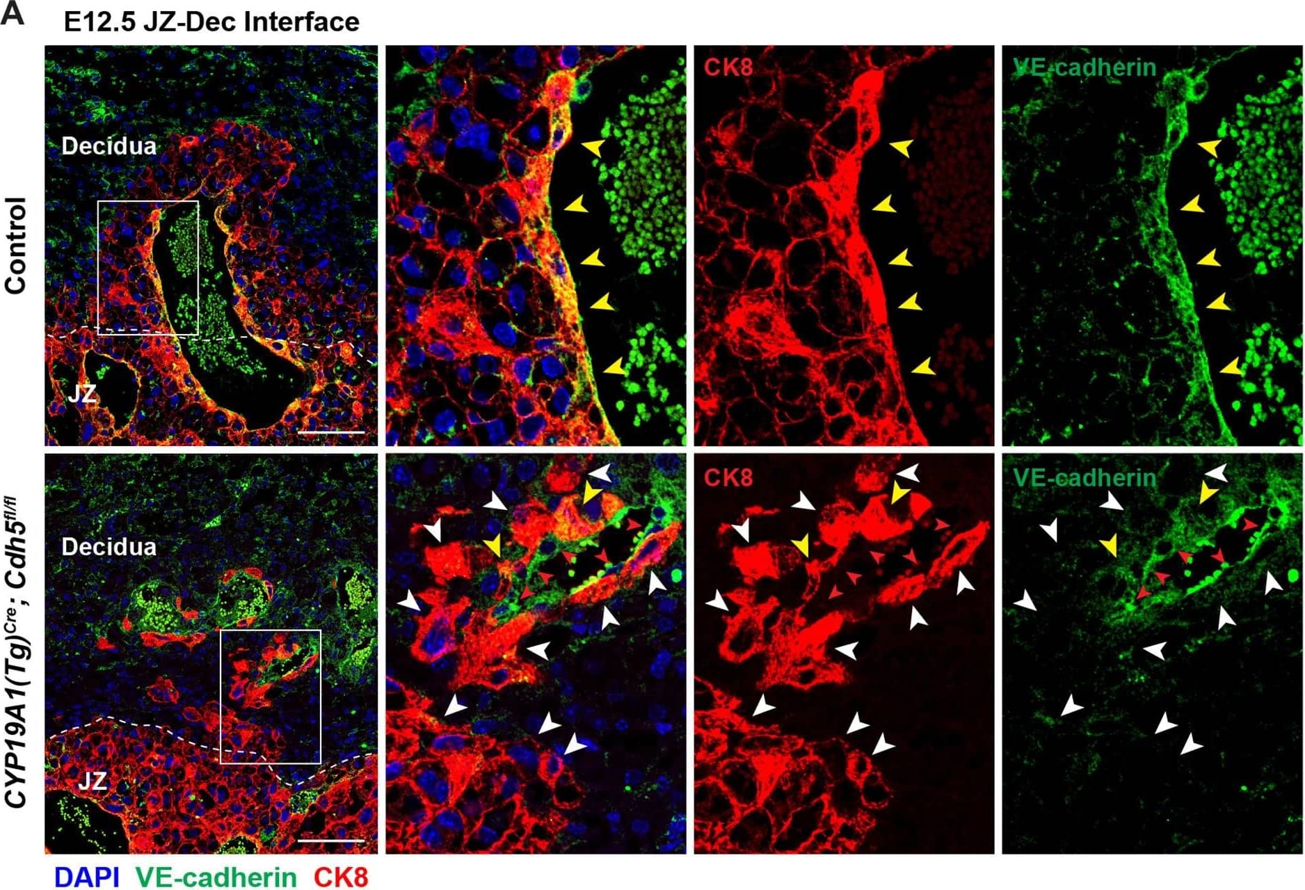 Detection of Mouse VE-Cadherin by Immunohistochemistry