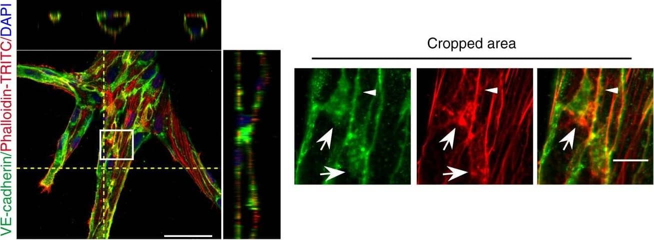 Detection of Mouse VE-Cadherin by Immunohistochemistry