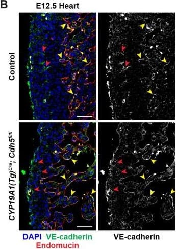 Detection of Mouse VE-Cadherin by Immunohistochemistry