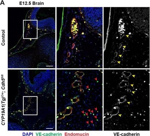 Detection of Mouse VE-Cadherin by Immunohistochemistry