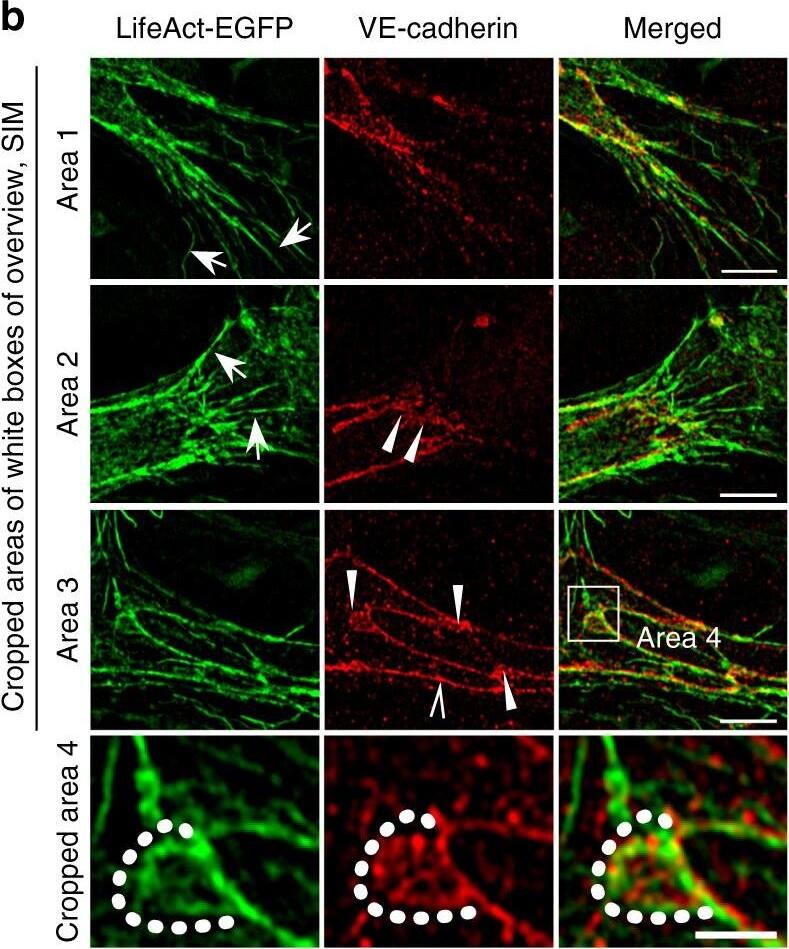 Detection of Mouse VE-Cadherin by Immunohistochemistry