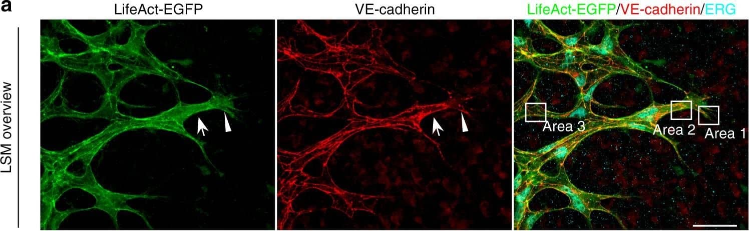 Detection of Mouse VE-Cadherin by Immunohistochemistry