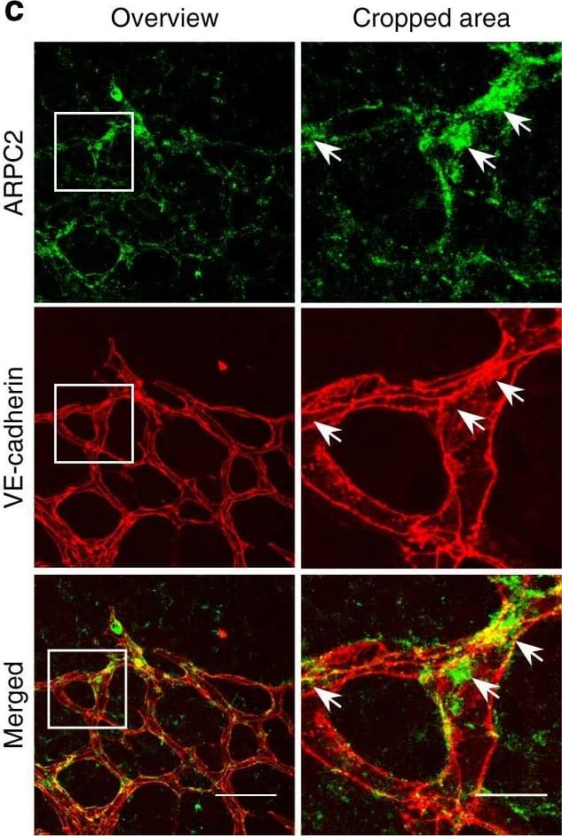 Detection of Mouse VE-Cadherin by Immunohistochemistry
