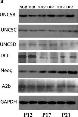 Detection of Mouse UNC5H2/UNC5B by Western Blot